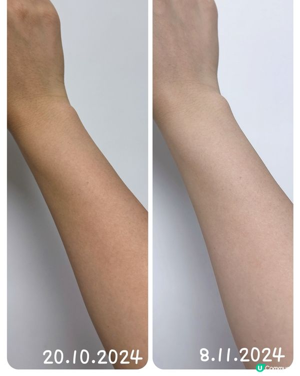 美白皮膚必需品