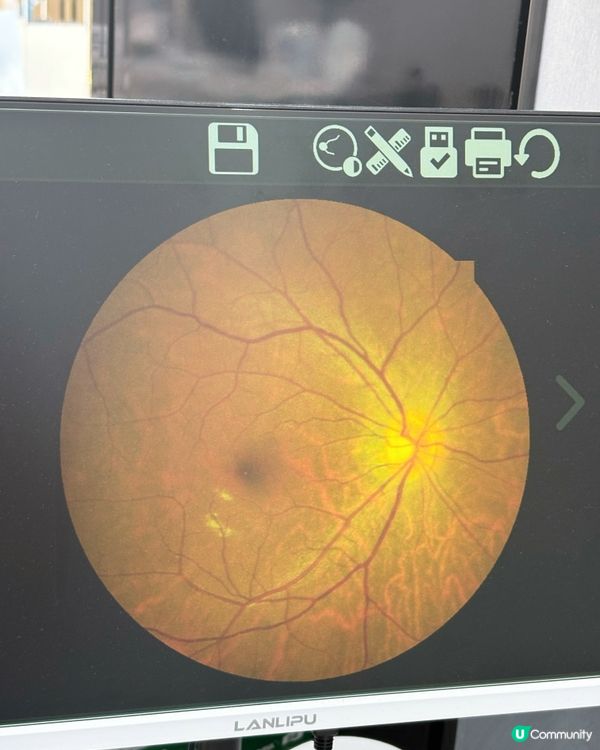 買眼鏡👓送免費眼部檢查! 👁️👁️