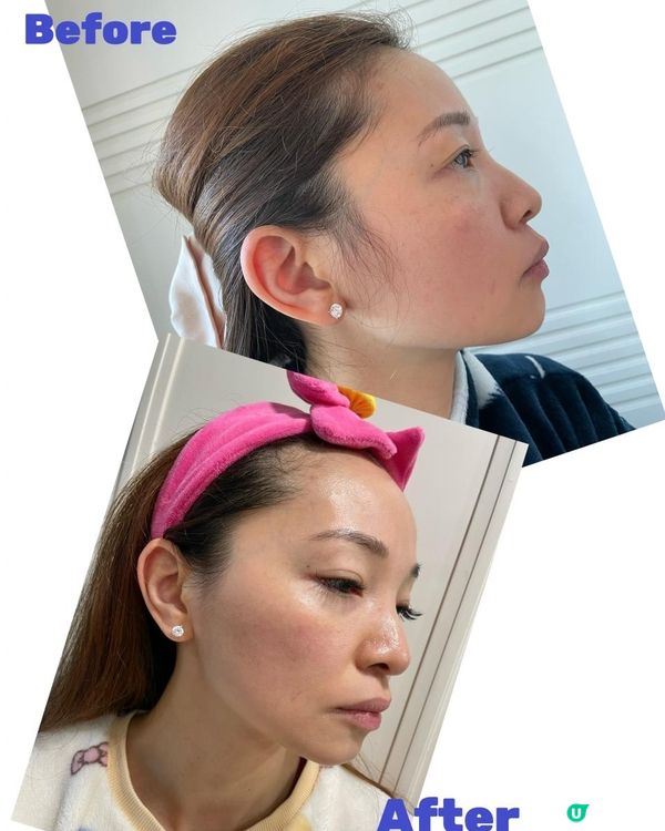 秋冬「極光瓶」保養肌膚靚靚