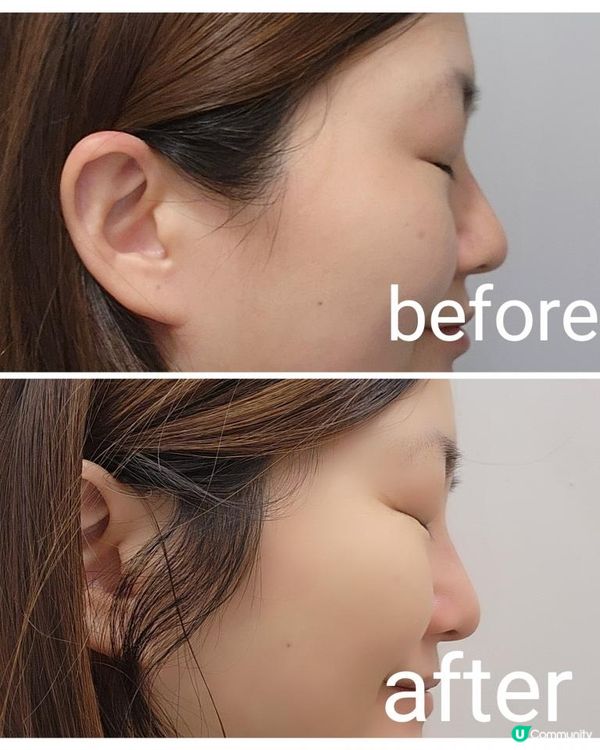 10分鐘ko 面部多個問題