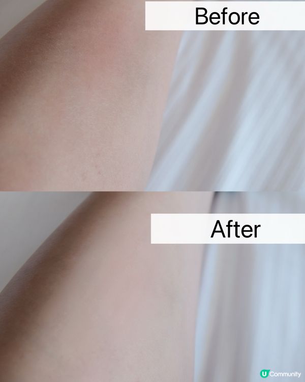 20秒搞掂乾癢？😱  
敏感肌救星！✨