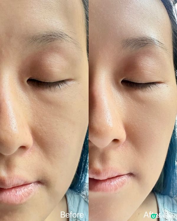 澳洲Grown Alchemist｜💦瞬效水光精華