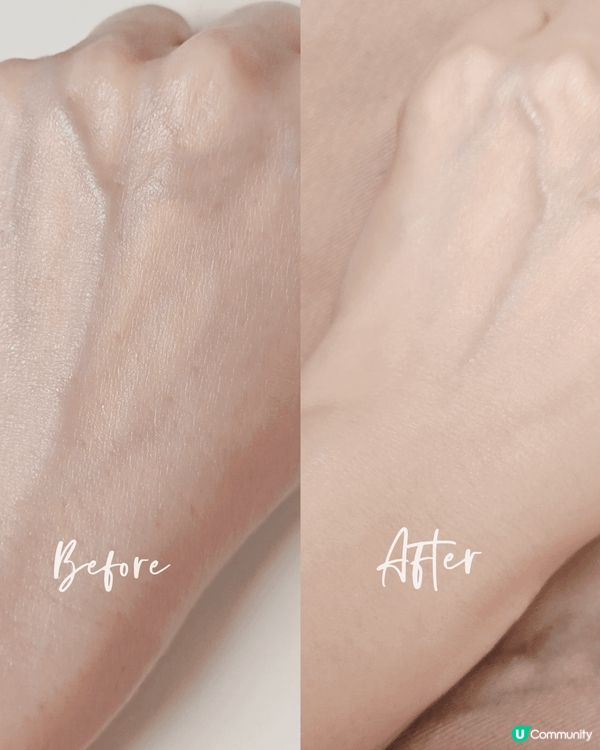 本身係敏感肌好易痕癢又出粒粒，特別係轉季時候就更加要留神！之...