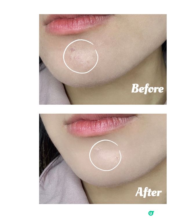 ✨ 白玉提亮乳霜+美容儀，居家光療🧏🏻‍♀️