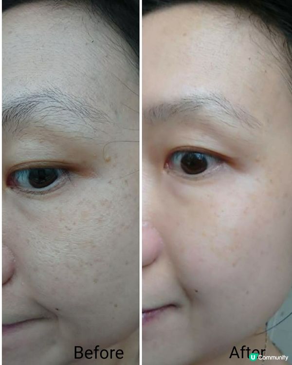 Tonymoly的GIMIYA去斑亮白淨肌限定套裝