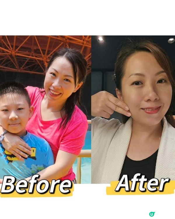 減極都唔瘦⁉️ 原來係肥菌作怪‼️