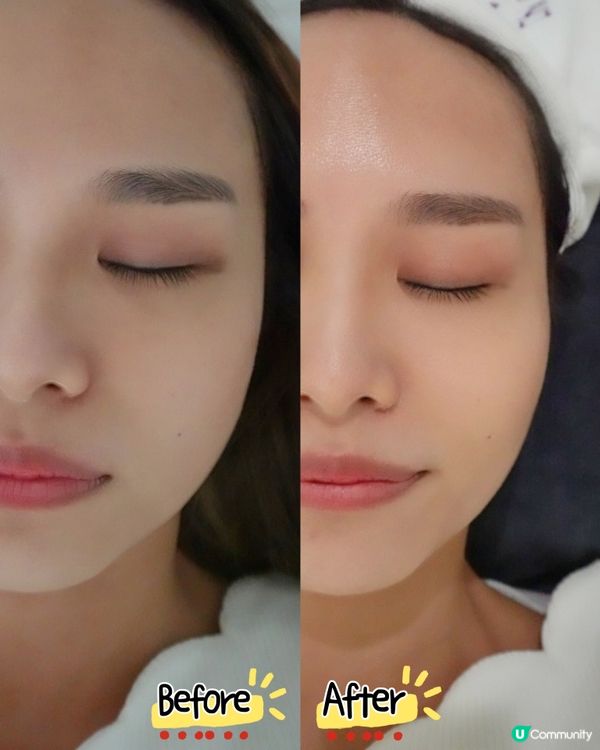 天氣乾到，皮膚乾到甩皮！即去荔枝角 mystyery.bea...