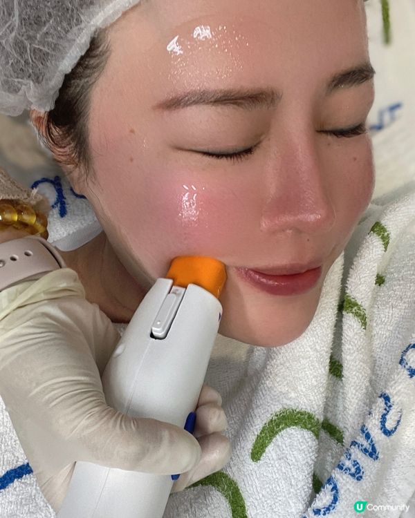 韓國no.1 緊膚療程🌟Oligio原美電波🌟