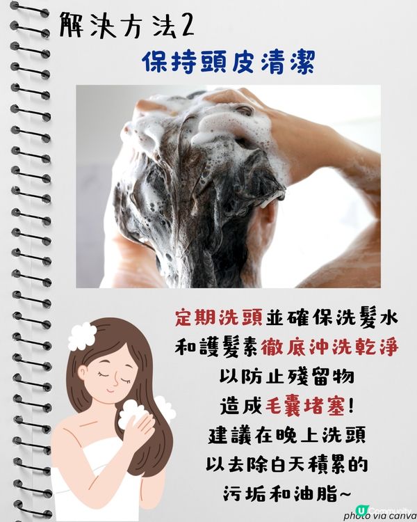 轉季甩頭髮四大原因 + 改善脫髮方法！食啲咩有助毛囊生長？4個壞習慣超傷髮！