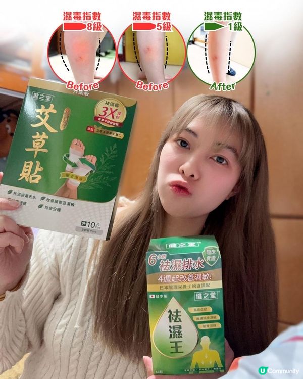 濕毒纏身？😩  告別水腫，重拾輕盈！🏃‍♀️