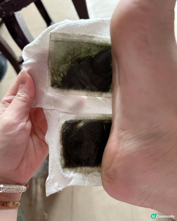 濕毒纏身？😩  告別水腫，重拾輕盈！🏃‍♀️