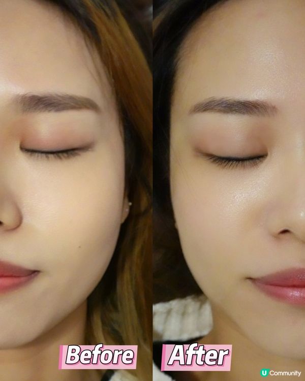 ## 12月派對季，靚靚出動！✨  
## 緊緻無針埋線