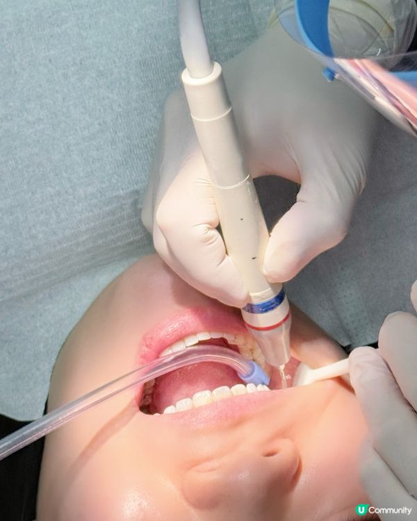 #格倫菲爾靚牙之旅 🦷😁!