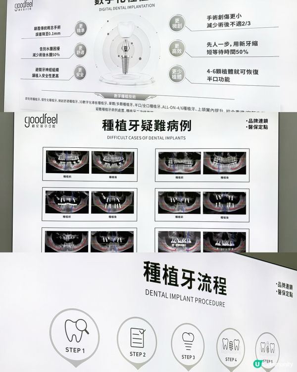 #格倫菲爾靚牙之旅 🦷😁!