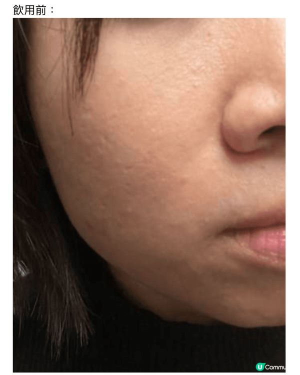 我成日覺得外在護膚品固然重要，但內在調理身體更重要❗️