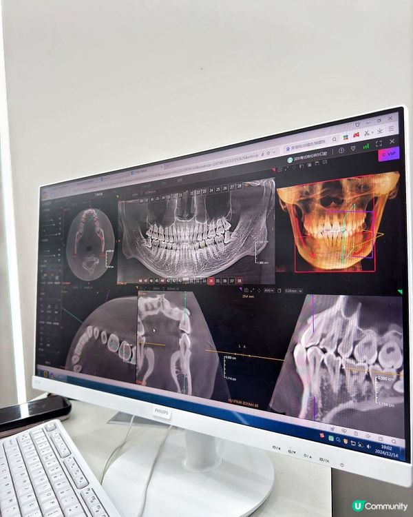 深圳睇牙就揀格倫菲爾🦷