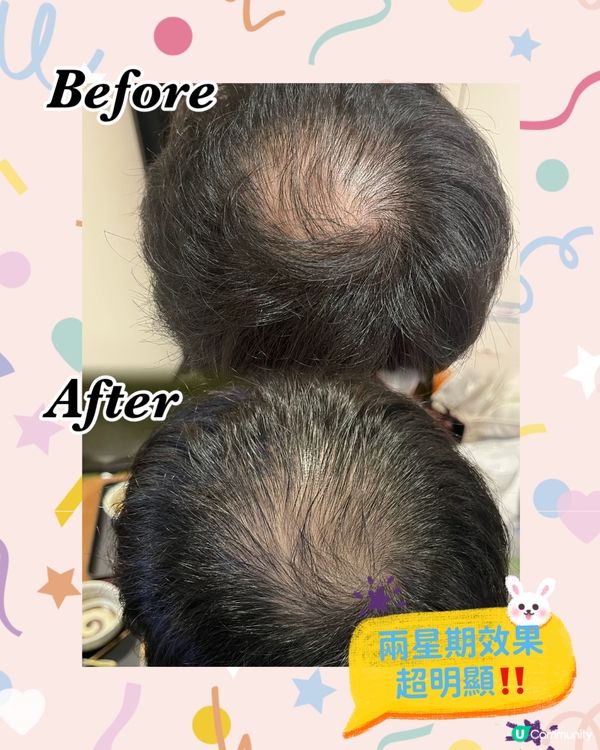 效果驚人嘅生髮帽