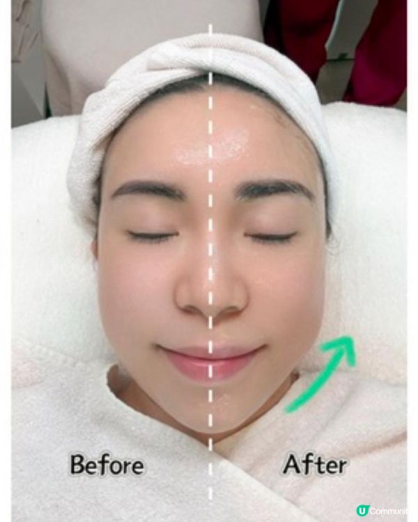 【輕鬆擁有緊緻V面效果！】