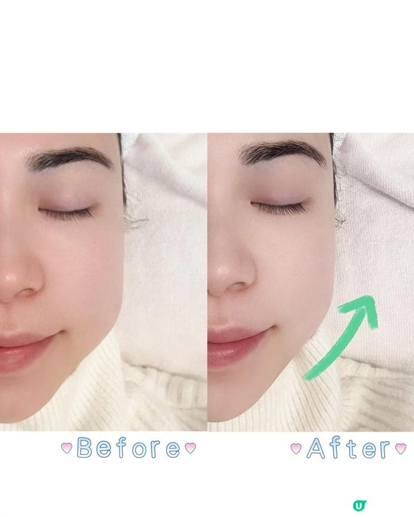 【輕鬆擁有緊緻V面效果！】