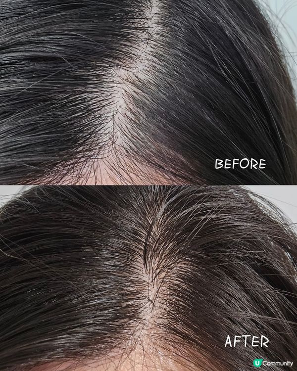 🎊新一年向脫髮說不 幫自己養髮活髮