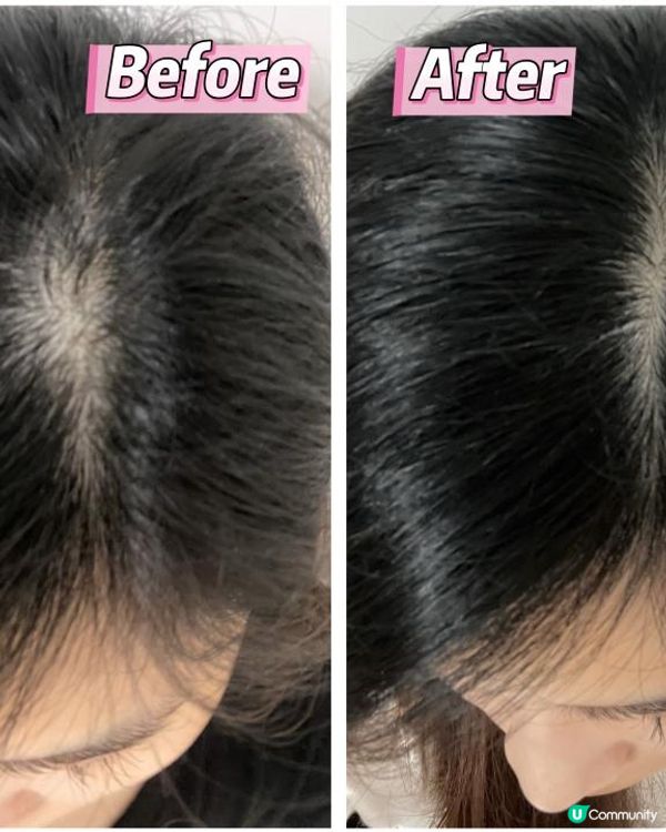 Yves Rocher皇牌 No.1 防脫育髮系列