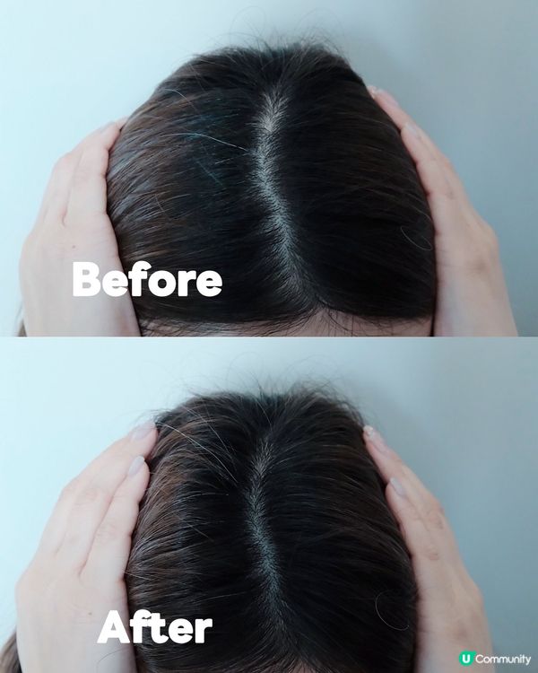 脫髮困擾？😭  皇牌救星登場！💪