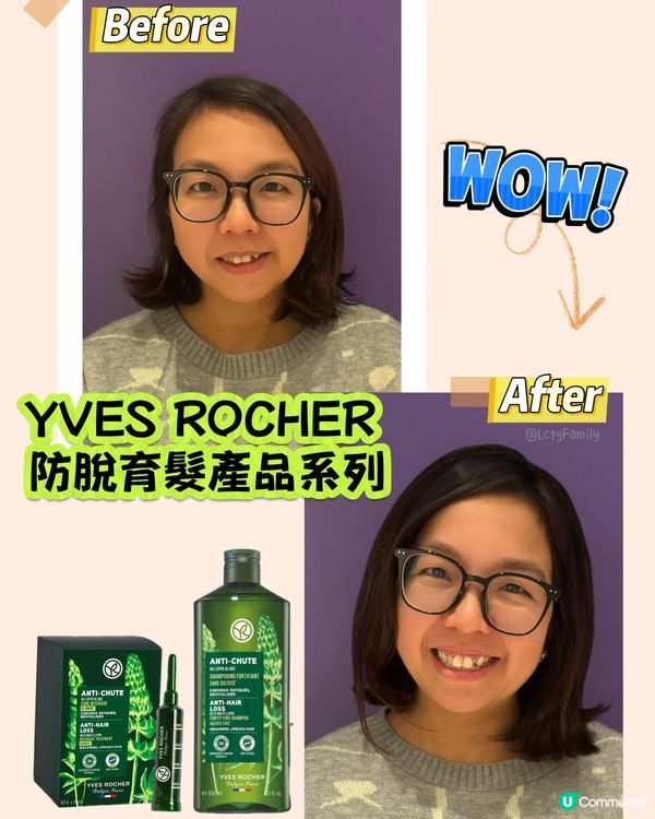 生仔甩頭髮😱😭生髮救星