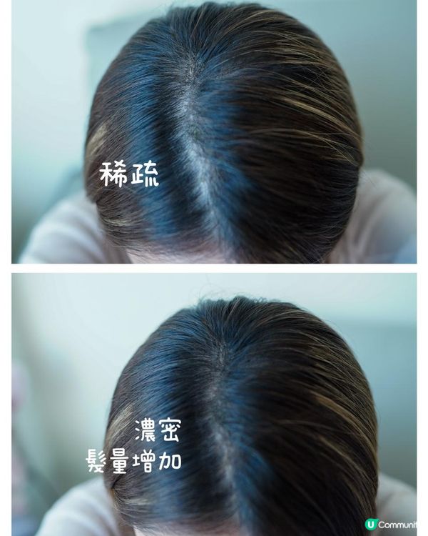 頭髮濃密秘訣🤫 新一年頭髮密密麻麻，自信滿滿！🤩