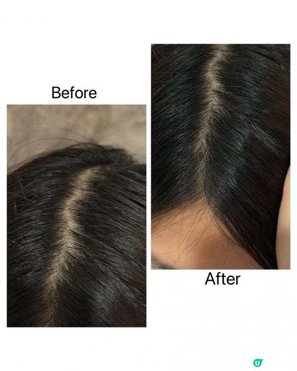 Yves Rocher No.1 皇牌防脫育髮系列 