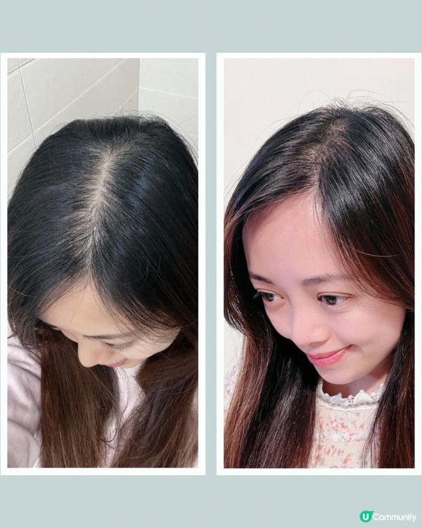 產後脫髮救星〰️YVES ROCHER 皇牌No.1防脫育髮系列