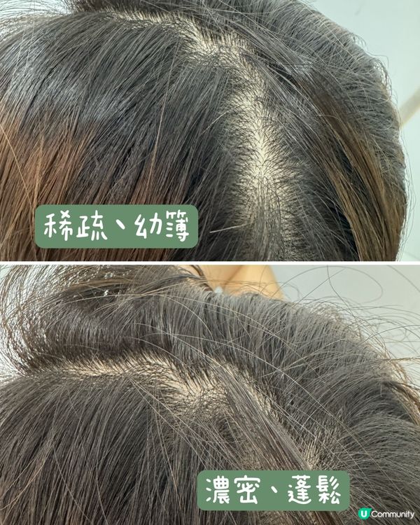 🌟✨【頭髮健康從根源開始】✨🌟