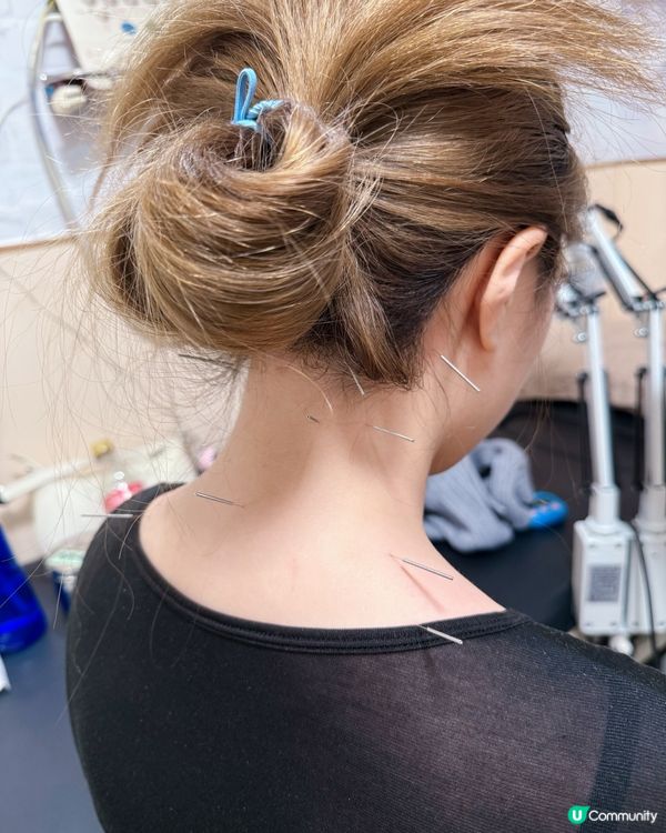 返工肩頸痛😩 御守中醫幫到你！