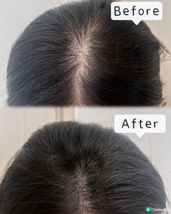 防脫育髮救星🪄Yves Rocher 皇牌防脫育髮系列