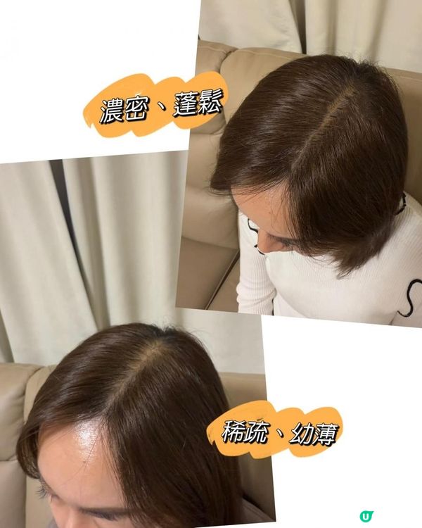 【 皇牌 No.1 防脫育髮系列 】