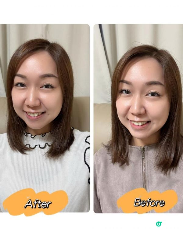 【 皇牌 No.1 防脫育髮系列 】