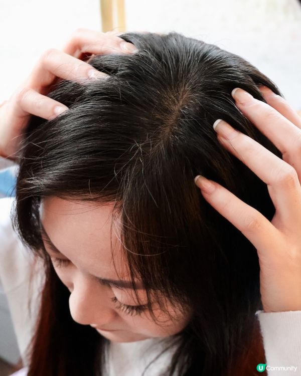 產後/壓力脫髮恩物