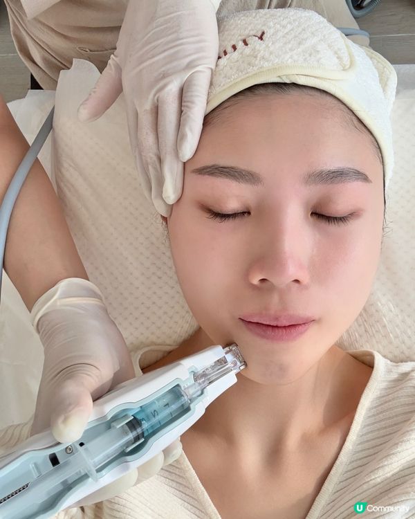 荔枝角靚靚美容店做納米無針水光槍