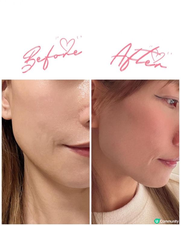 Meditherapy V臉緊緻系列 讓你安在家中全面護膚