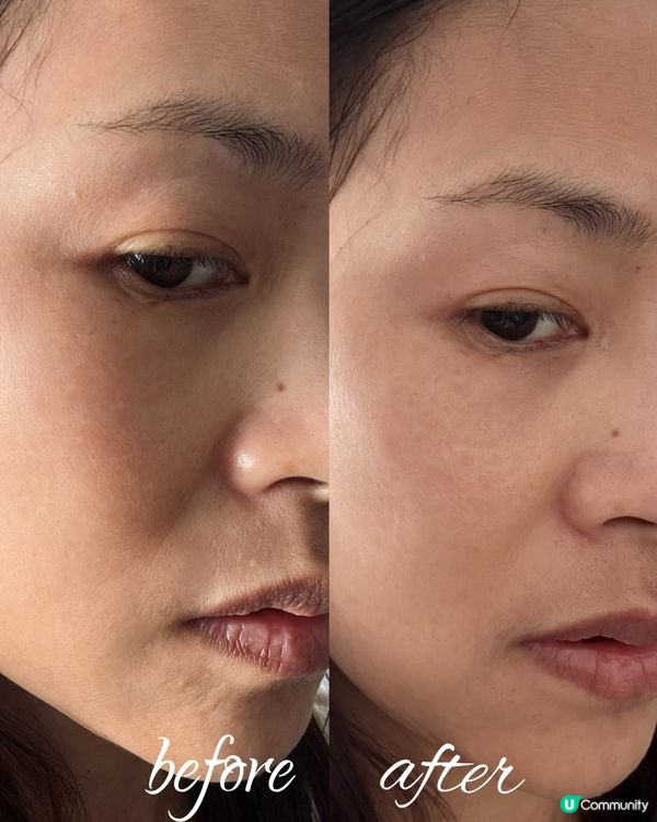 好舒服舒緩皮膚