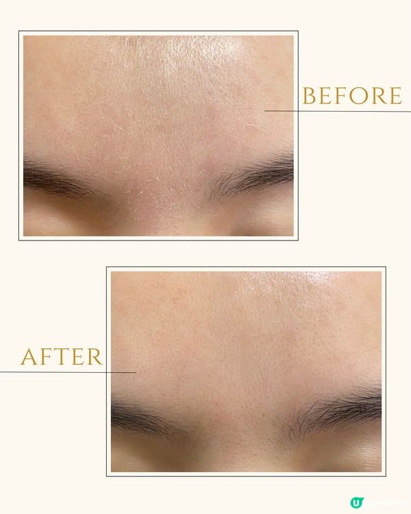 INFYNYTI￨修護維他命 B5面霜