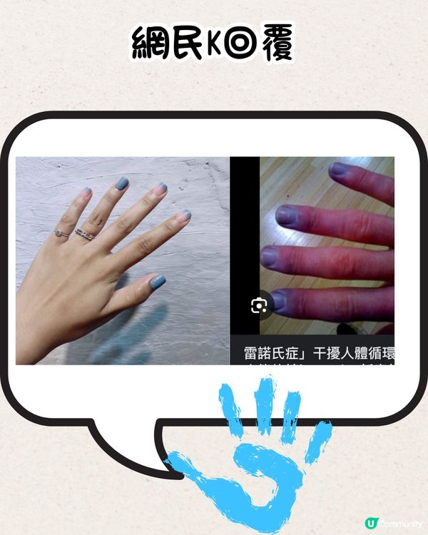 網民分享爆笑美甲款式💅瓜子、花生糖、鮑魚都有？