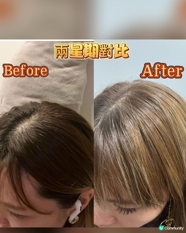 強韌頭髮及防脫髮套裝