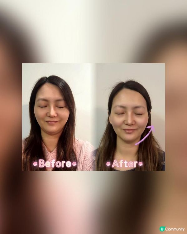 ZIIP HALO 我的肌膚救星