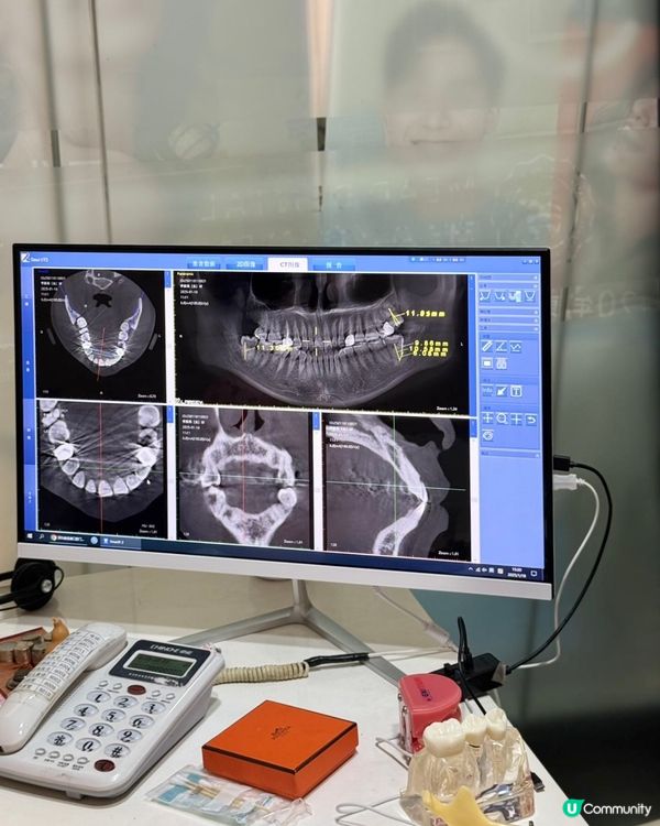 笑口常開😁🦷 幫你搞掂牙齒問題！