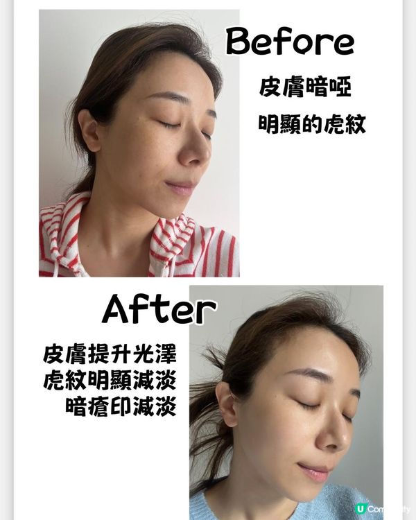 ｛好物分享｝⚡️新一代 CurrentBody Skin LED 光療面膜儀