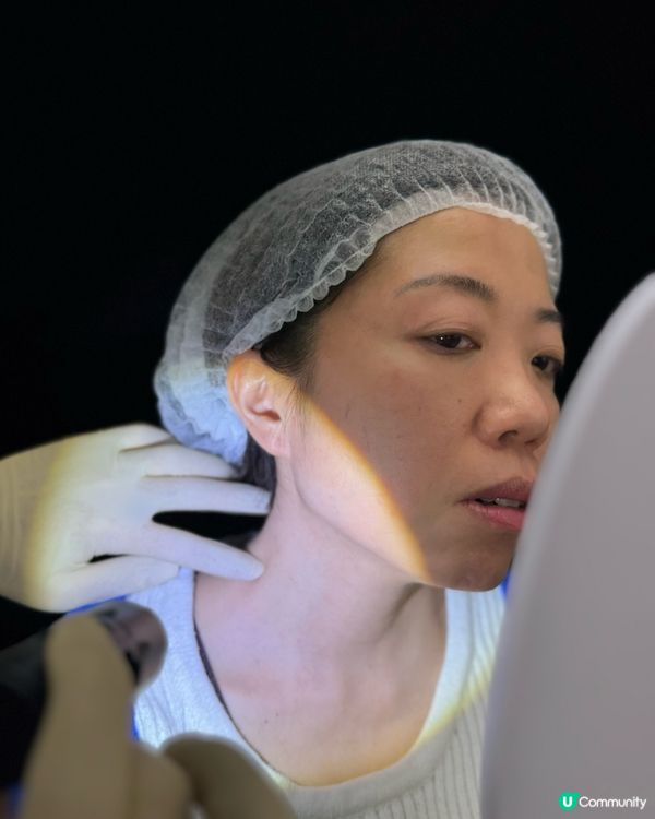 疣不單止影響外觀，仲會傳染俾身邊嘅人🥲分享吓脫疣經歷～😗