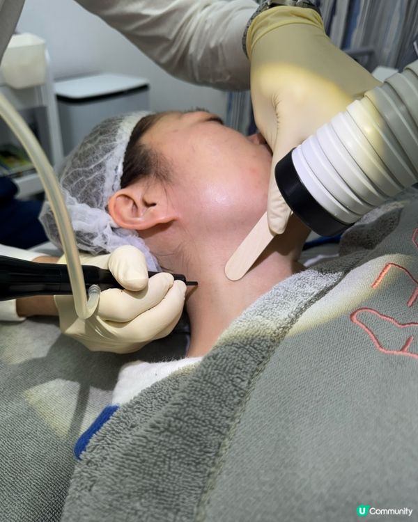 疣不單止影響外觀，仲會傳染俾身邊嘅人🥲分享吓脫疣經歷～😗