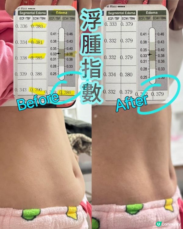 真正實測 服用後有減到浮腫！