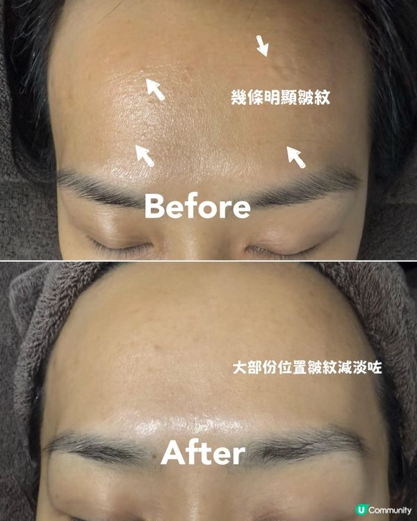 性價比高的 facial ~ 爽爽