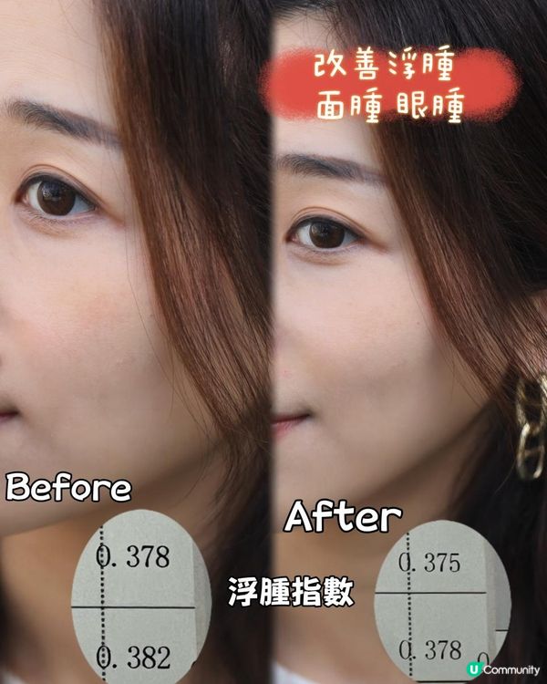 {養生分享｝💧💦維特健靈袪濕輕